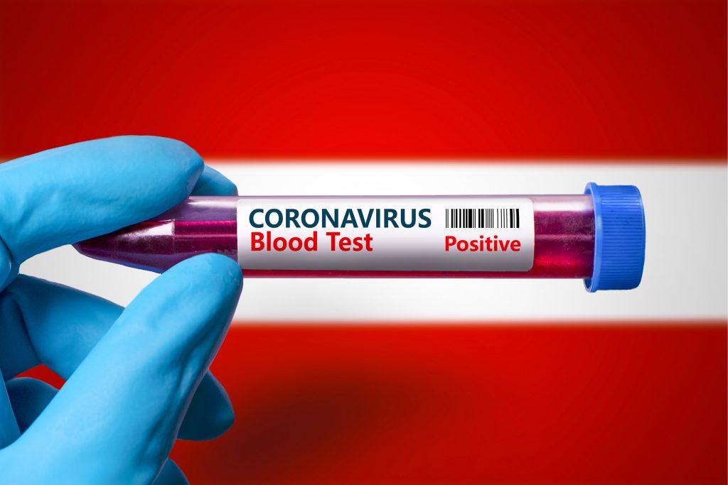 Avusturya’ya 32 Ülkeden Gelenlere Kovid-19 Testi Zorunluluğu