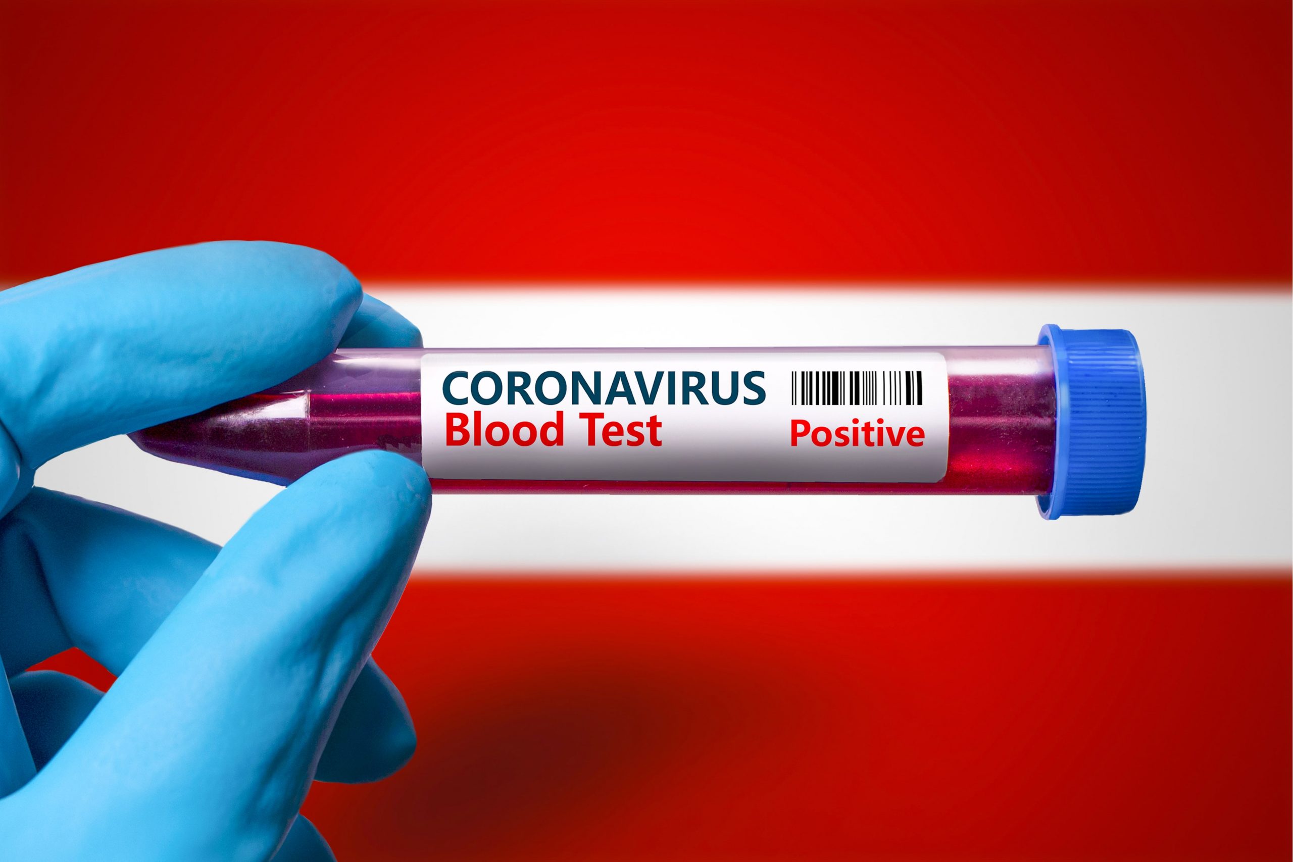 Avusturya Kovid-19 testi