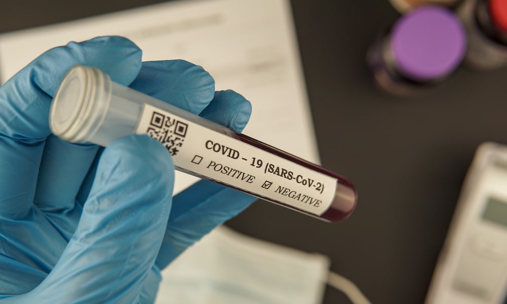 Kovid-19 negatif test sonucu