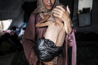 Gazze’de Aç Bırakılmaktan Kaynaklı Ölümler Artarken Çözümsüzlük Sürüyor